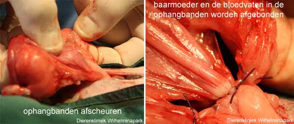 De baarmoeder en ophangbanden worden met hechtdraad op 3 plaatsen afgebonden